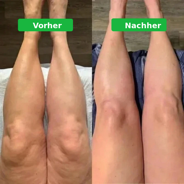 Lymph-Tropfen