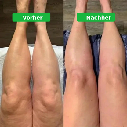 Lymph-Tropfen